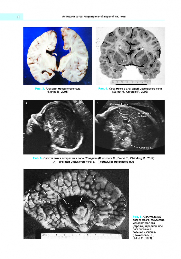 <b>Книга</b>: <b>Аномалии</b> развития нервной и сердечно-сосудистой систем. 
