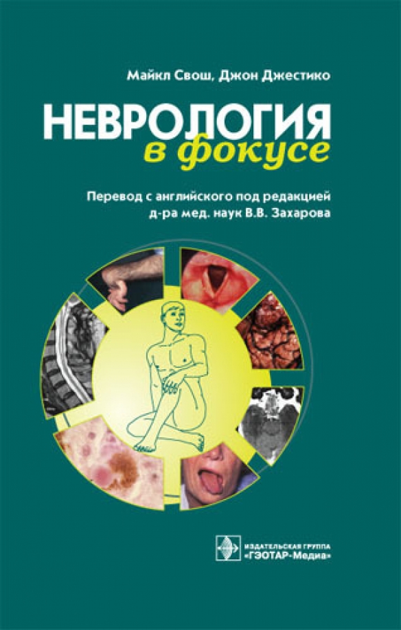 Парфенов неврология учебник. Неврология книги. Учебник по неврологии. Книги по неврологии для студентов. Неврология для вузов