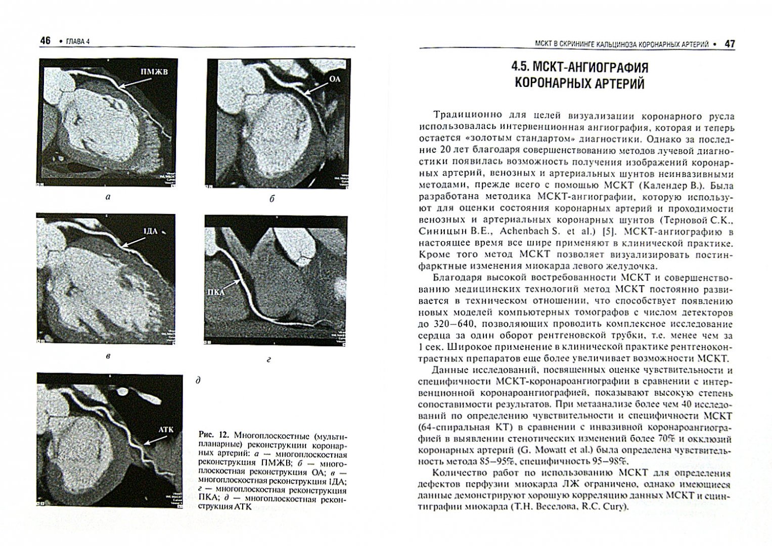 Коронарные артерии сердца на кт. Кт ангиография аневризма. Кт томограмма головного мозга. Мскт-ангиография артерий нижних конечностей. Томограмма почек с контрастным веществом.