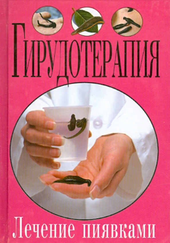Купить Книгу Лечение Пиявками