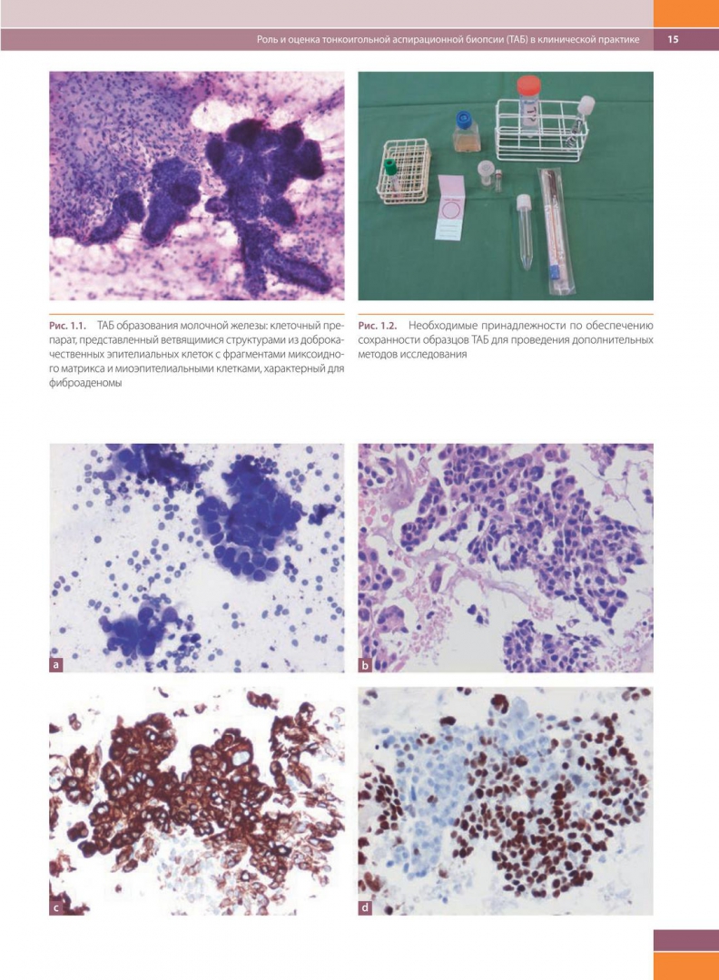 Биопсия и цитологическое исследование. Цитологические методы. Гистология и биопсия в чем разница. Биопсия и цитологическое исследование. Гистология или биопсия.